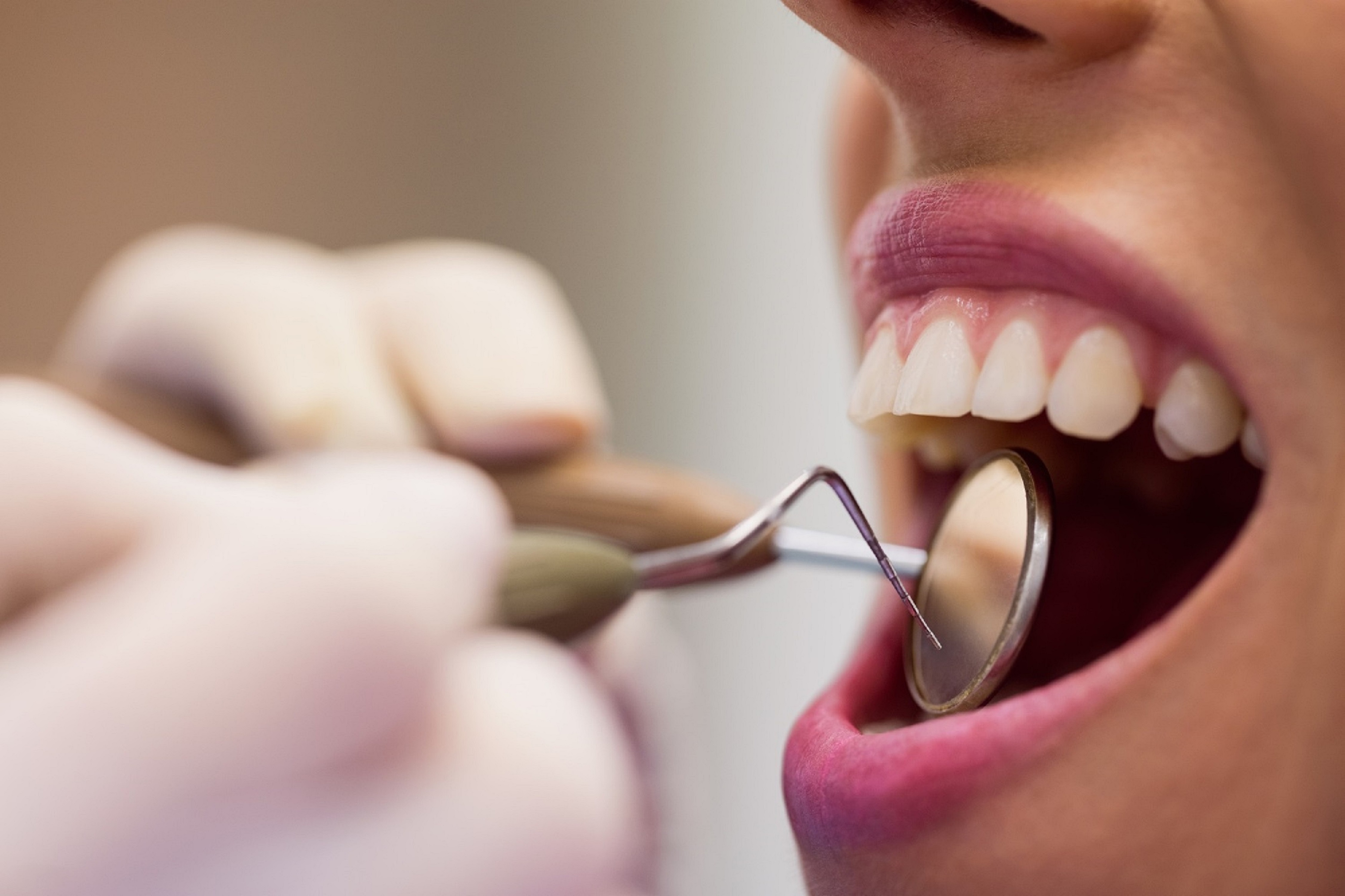 Implantes dentários podem ser a solução para problemas de saúde bucal? especialista diz que sim