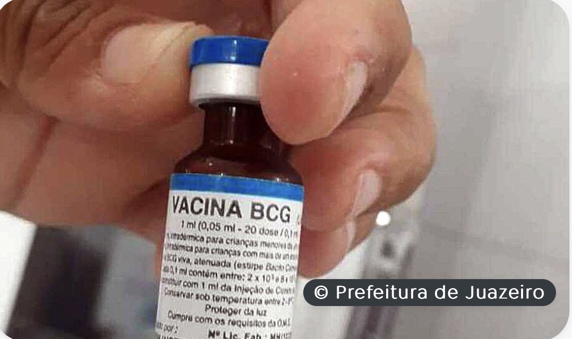 Pacientes reumáticos têm mais risco de desenvolver tuberculose